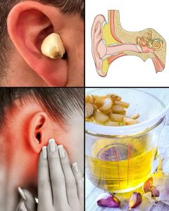 Ajo para la Salud del Oído: Alivio Natural y Protección