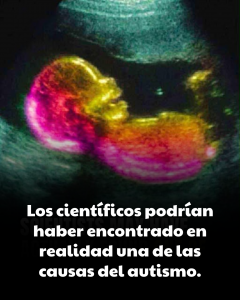 Estudio identifica posible conexión con el desarrollo del autismo